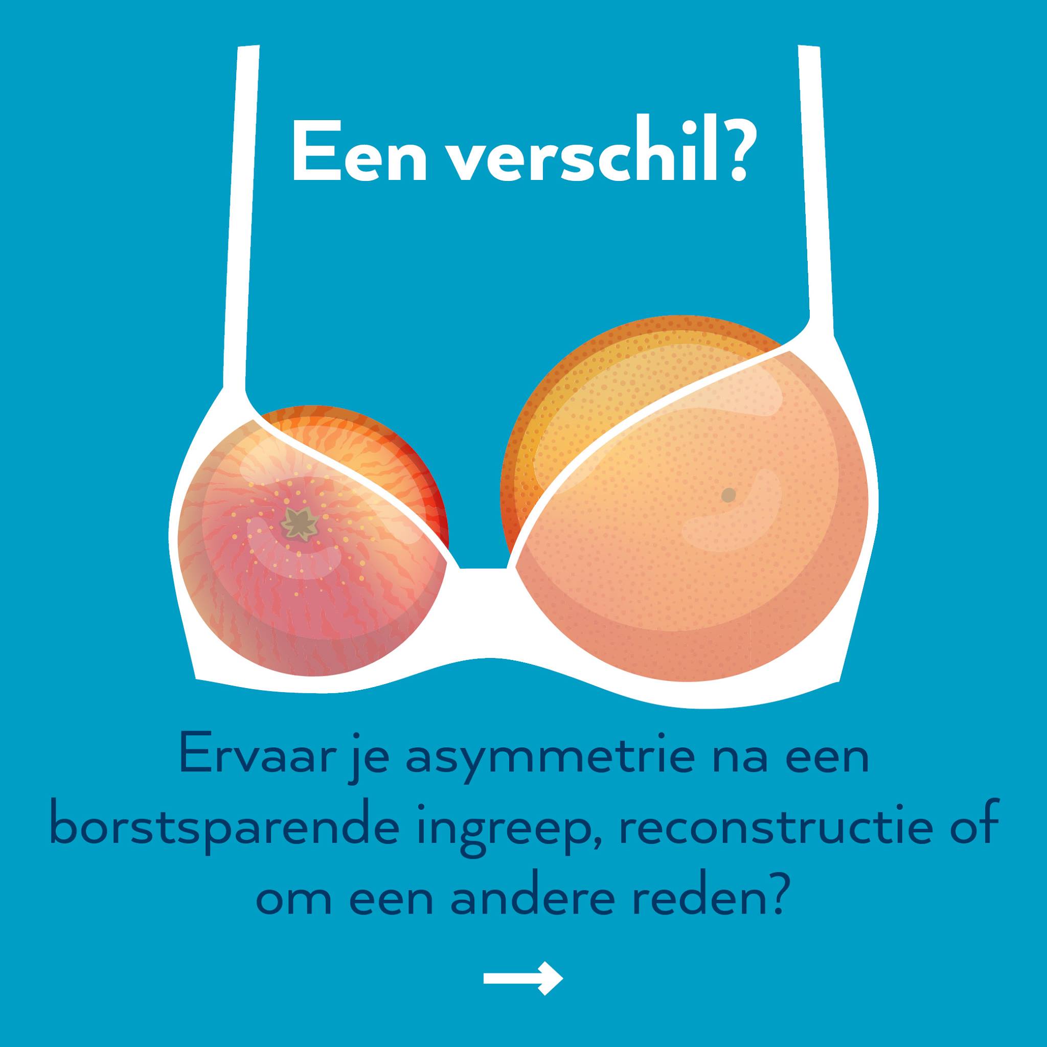 Shapers_FiguraLIngerie_Sliedrecht Shapers_FiguraLIngerie_Sliedrecht